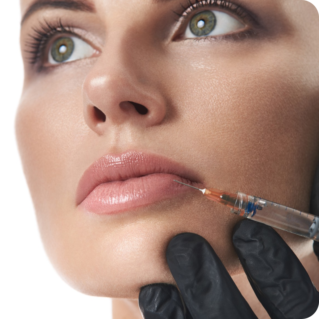 Preenchimento Labial